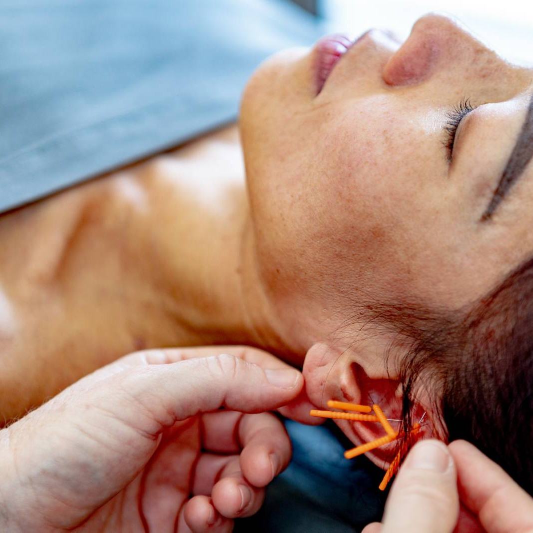 Acupuncture-05-Carola 3 Acupuncture 05 Carola uai