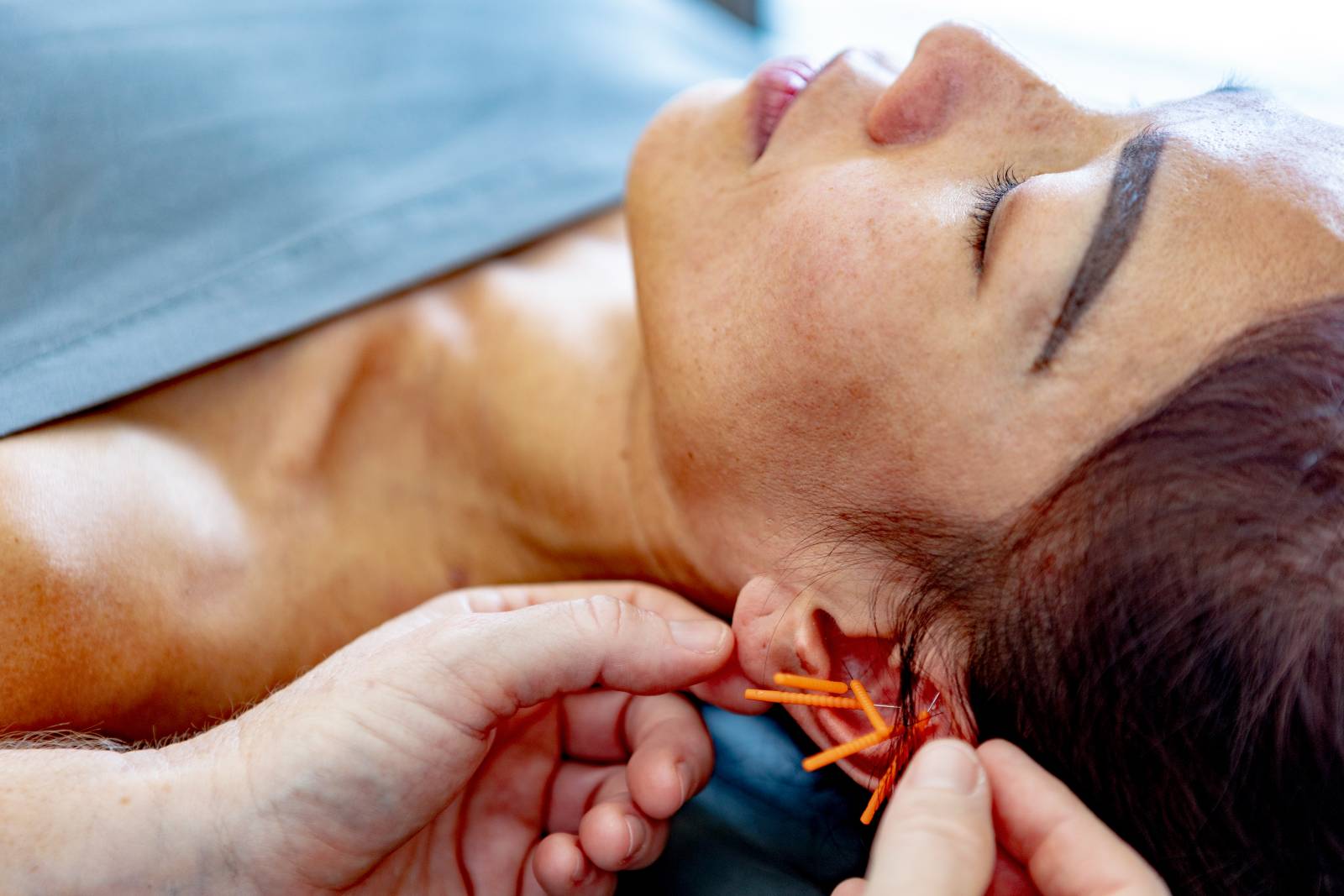 Acupuncture-05-Carola 7 Acupuncture 05 Carola