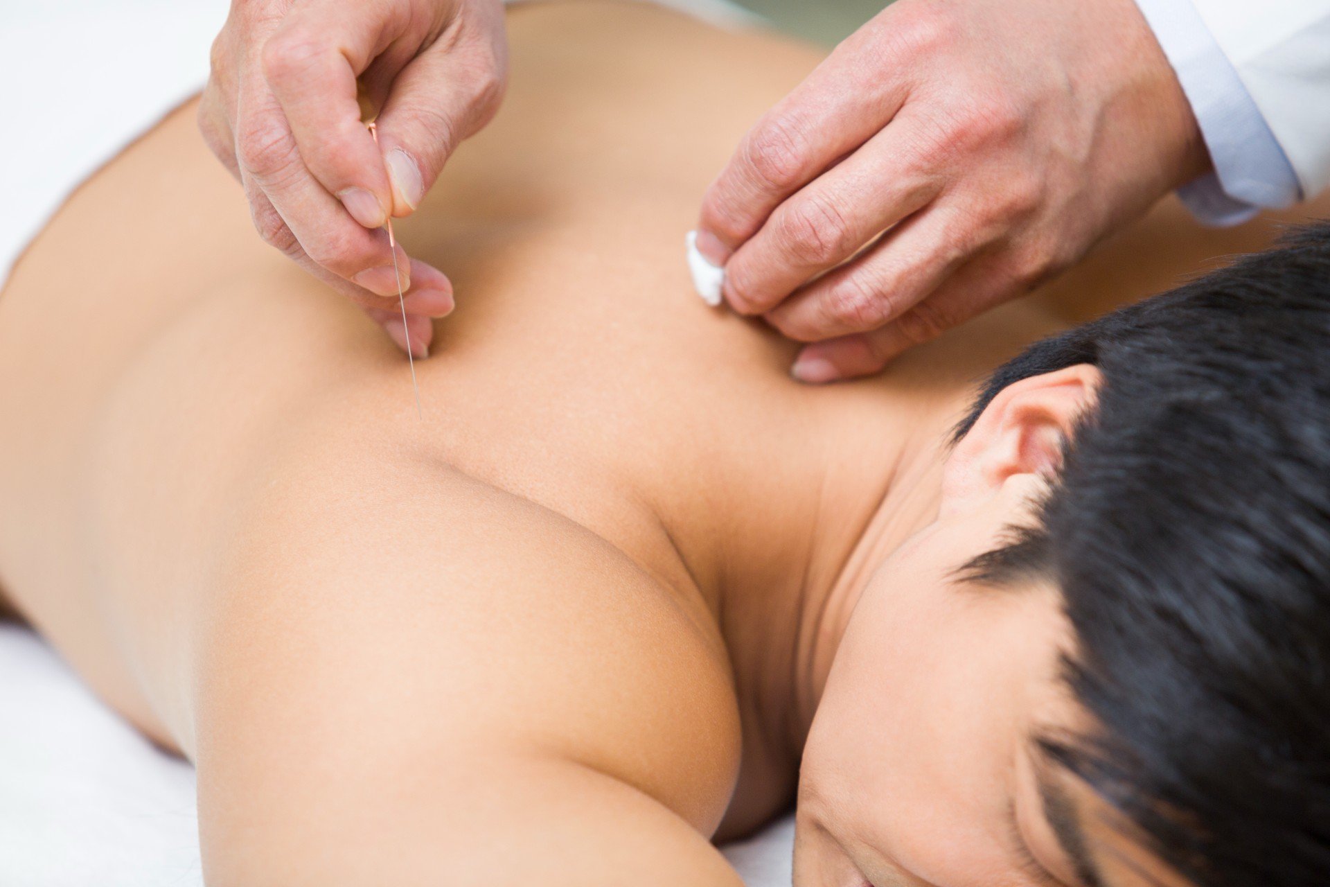 How do I know if Acupuncture is right for me? 15 Acupucnture 08