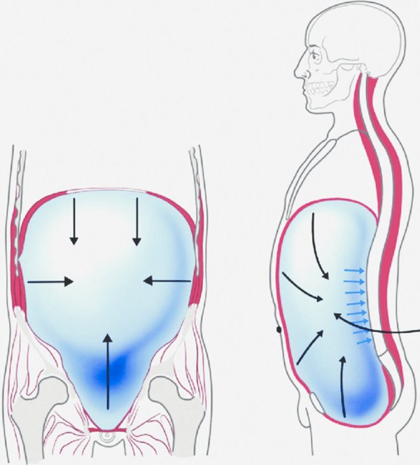 intra-abdominal-pressure 4 intra abdominal pressure